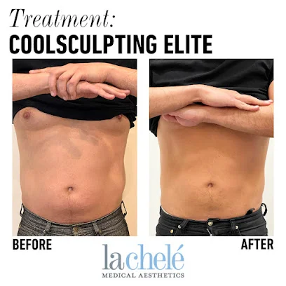 La Chelè Medical Aesthetics Upper Dublin logo