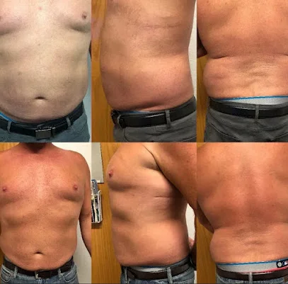 Transcend Total Body Rejuvenation logo