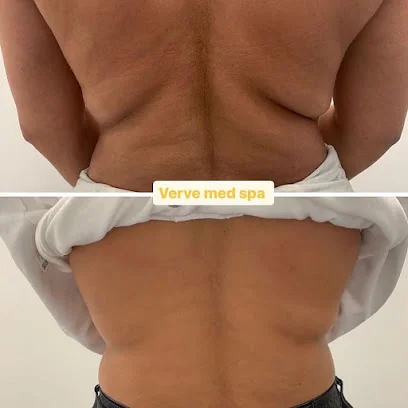 Verve Med Spa & Laser Aesthetics logo